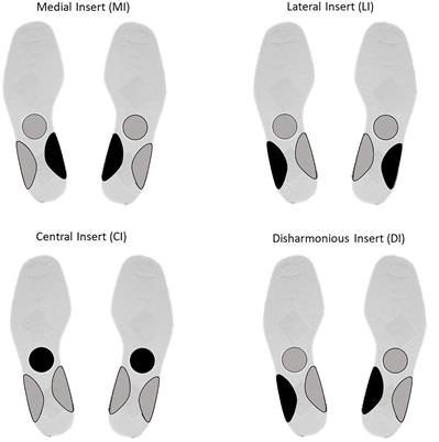 Postural Changes During Exteroceptive Thin Plantar Stimulation: The Effect of Prolonged Use and Different Plantar Localizations